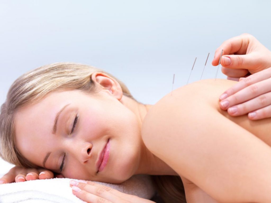 What Exactly Is Dry Needling Shoulder, and How Exactly Can It Benefit You?
